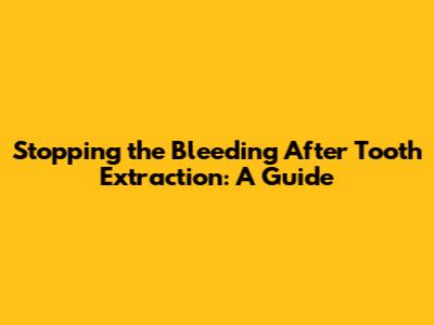 Stopping the Bleeding After Tooth Extraction: A Guide